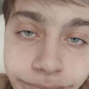 ,  epilepty, 45