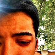  ,   Rakhbarov JR, 36 ,   ,   , c 