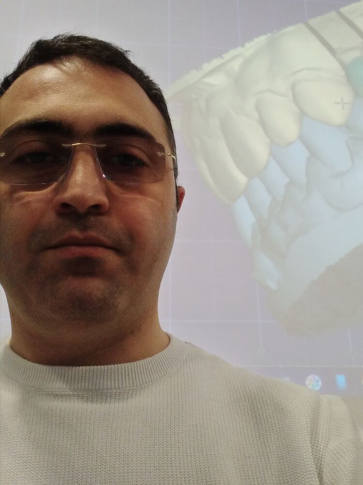 ���� 29385290 ������� Azer, 39 ���, ���� ���������� � ����