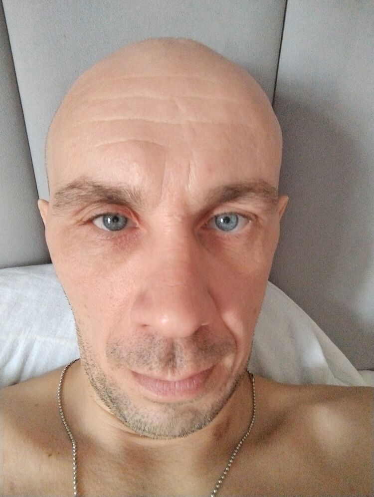 34332570  , 39 ,    