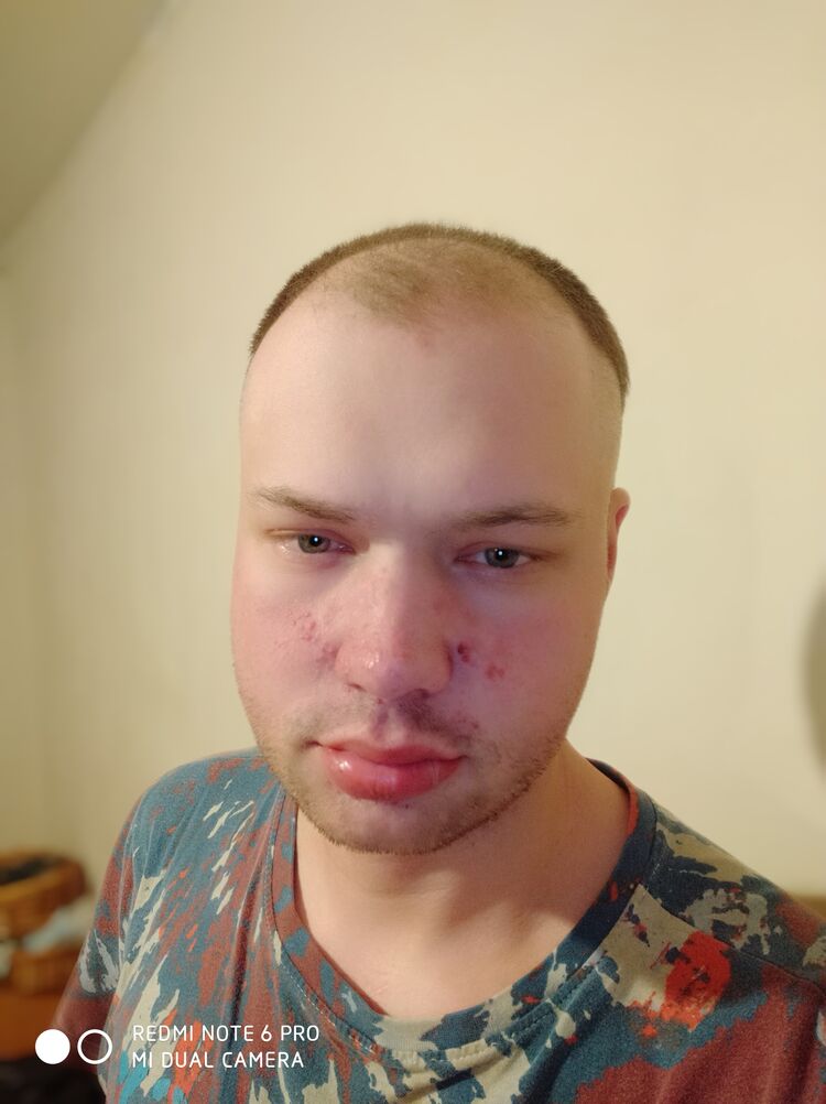 ���� 25109170 ������� �����, 36 ���, ���� ���������� � ���