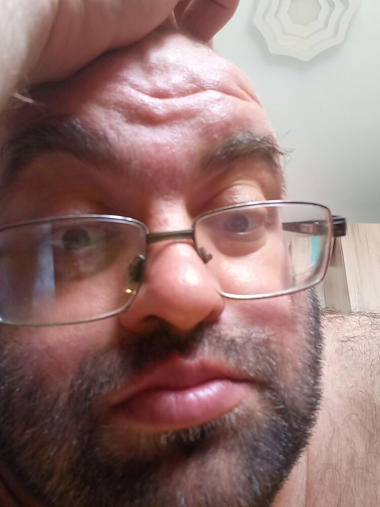  52381060  , 38 ,    --