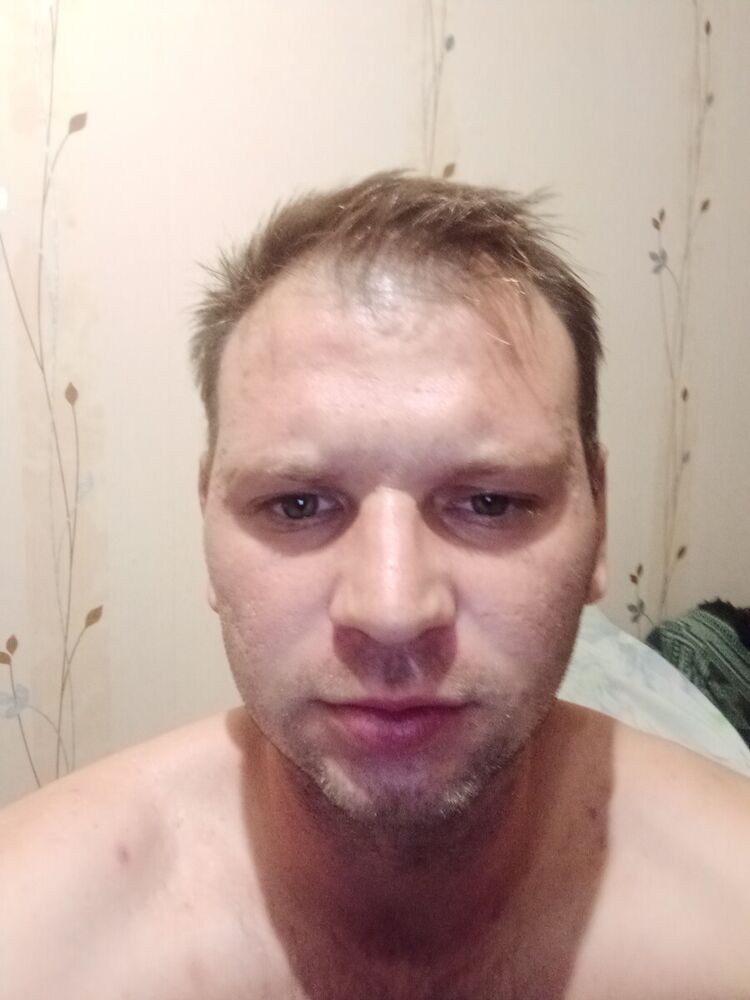  20538160  , 36 ,    --