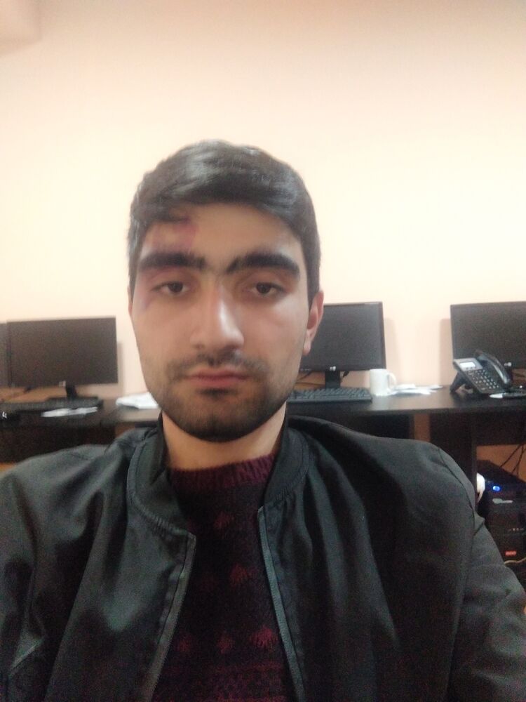  ,   Arsen, 25 ,   ,   