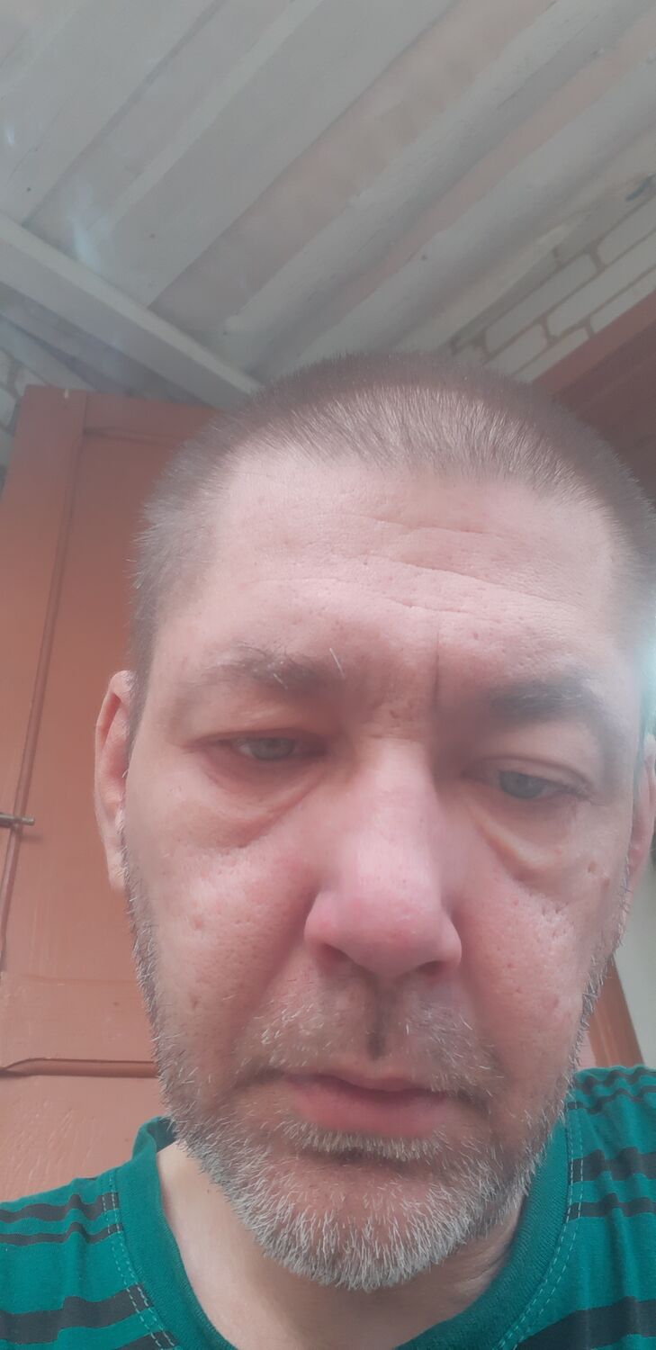  42862360  , 44 ,     