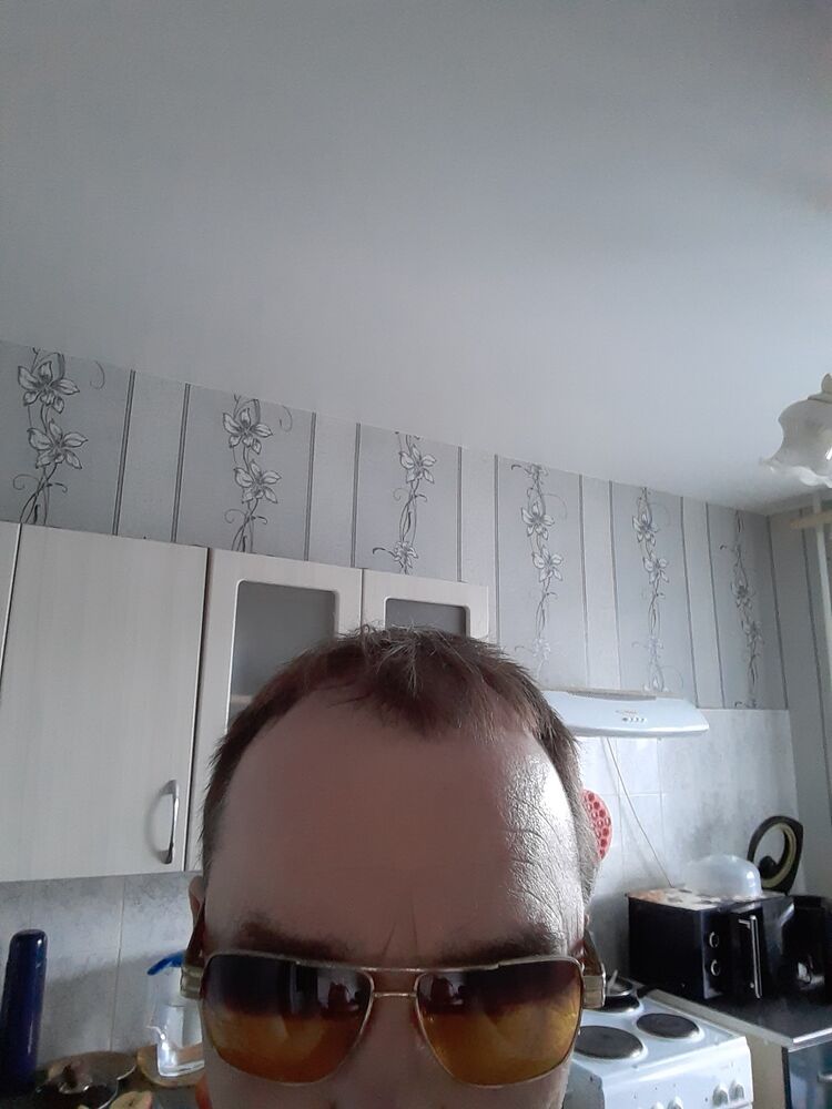  41628090  , 55 ,    
