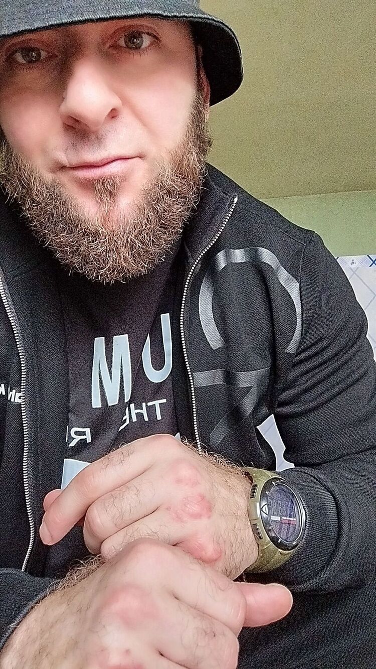  53792960  , 35 ,    