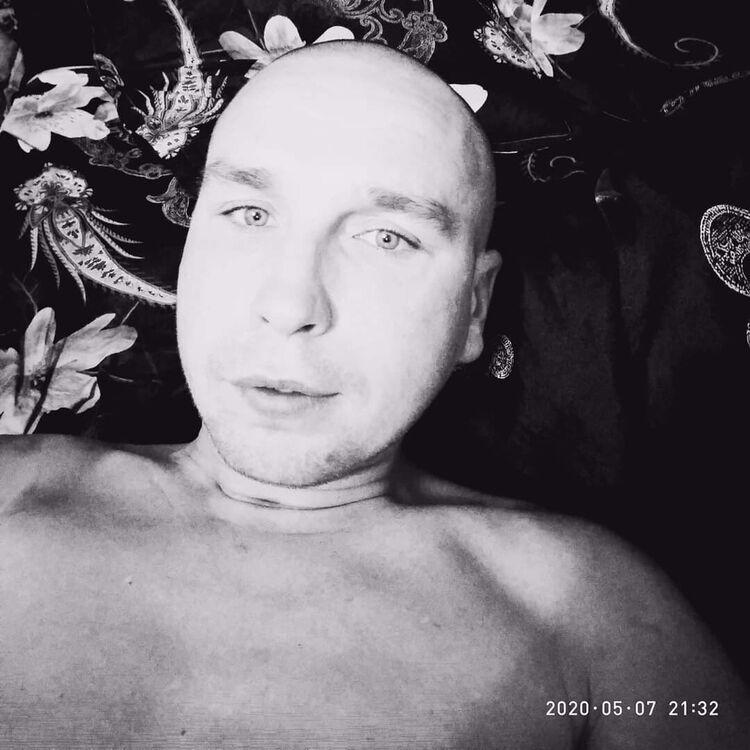  21627820  , 35 ,    