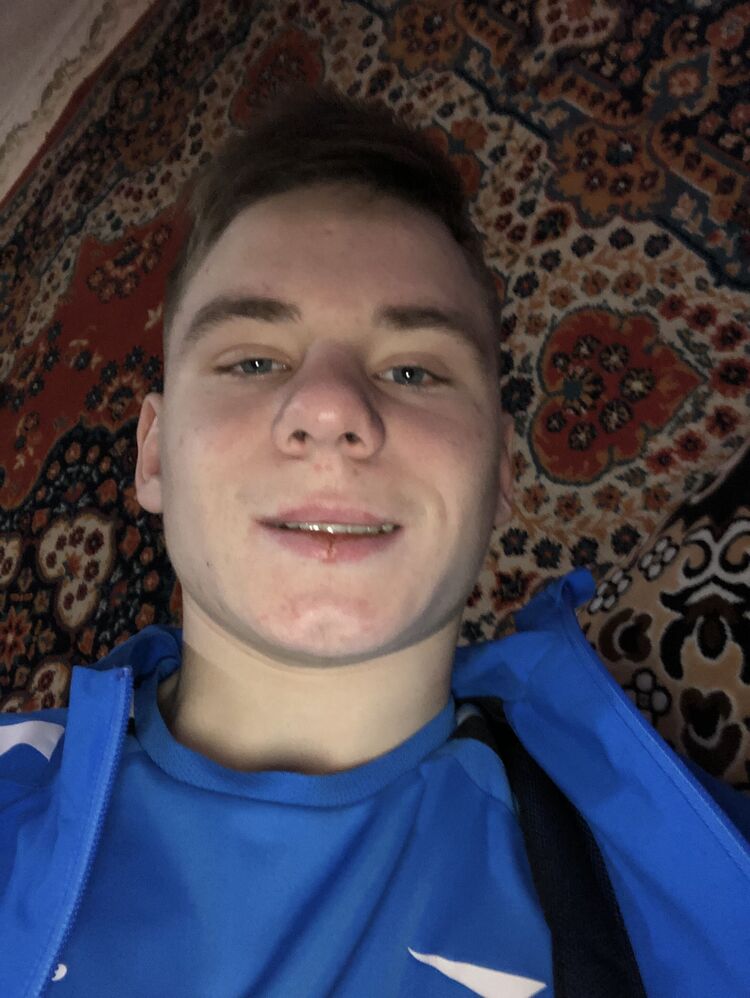  33562380  , 20 ,    --