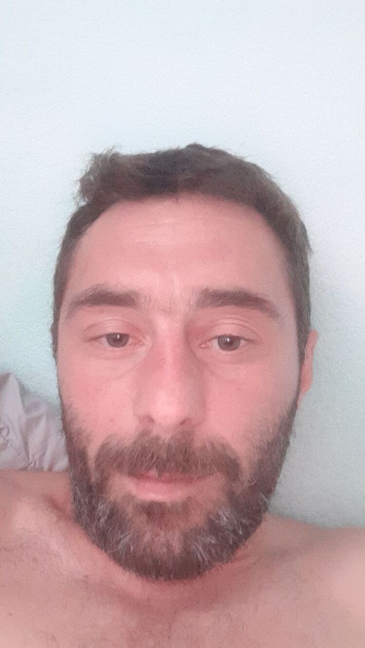  28116730  Anzo, 40 ,    