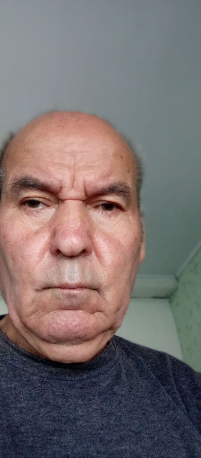  38564430  , 78 ,    