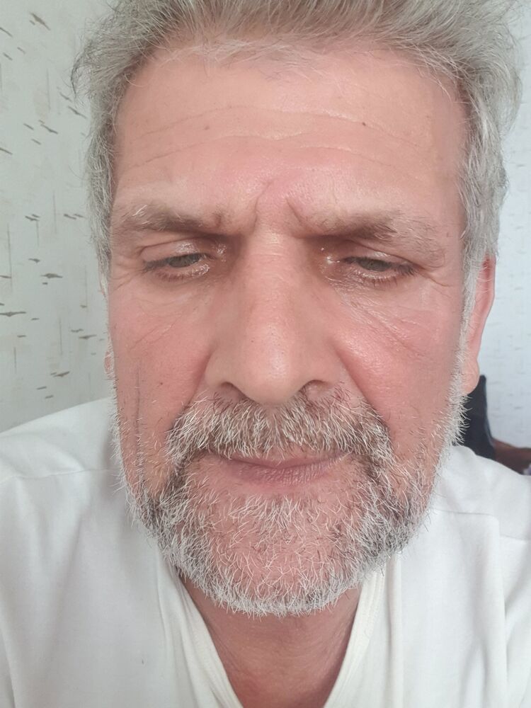  34024290  , 44 ,    