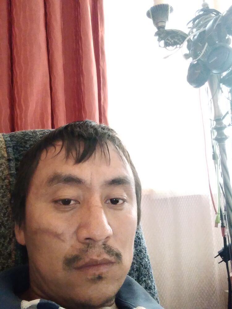  29970380  , 43 ,    