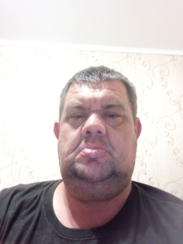  36745870  , 43 ,    