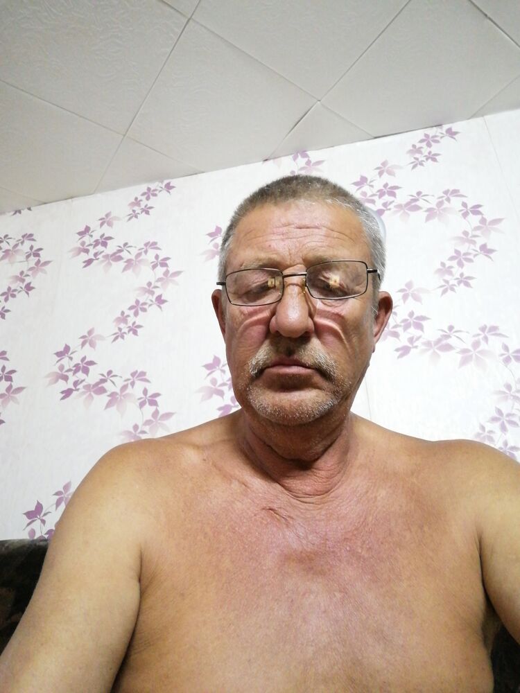  34915890  , 65 ,    