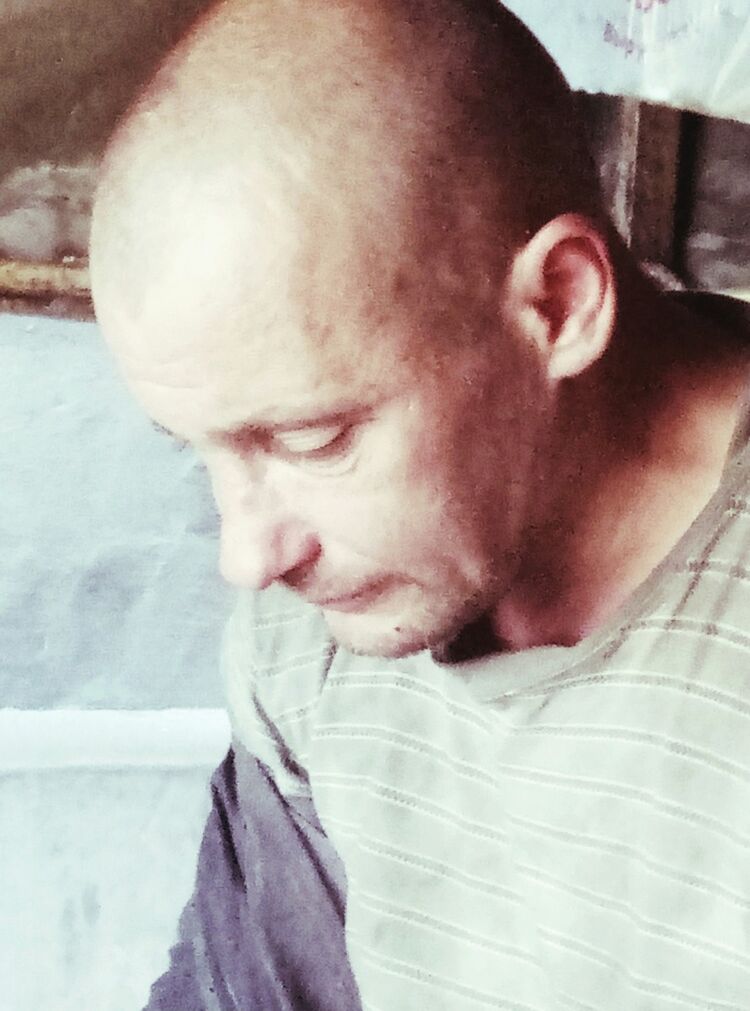  17236530  , 35 ,    