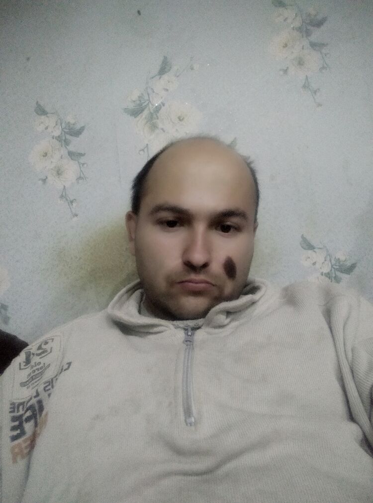  29844720  , 36 ,    