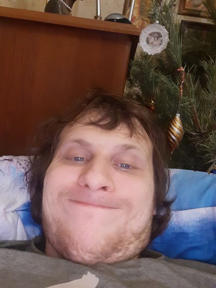  24815490  , 33 ,    