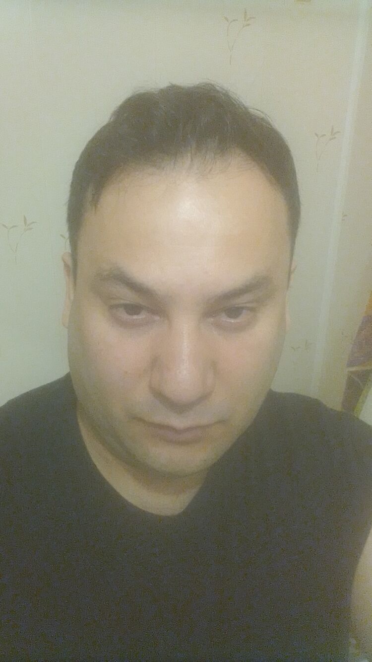  35353380  , 47 ,    