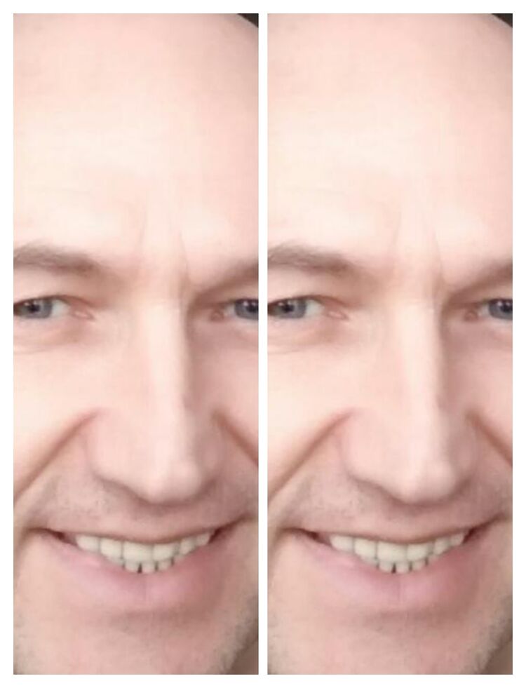  29094670  , 54 ,    -