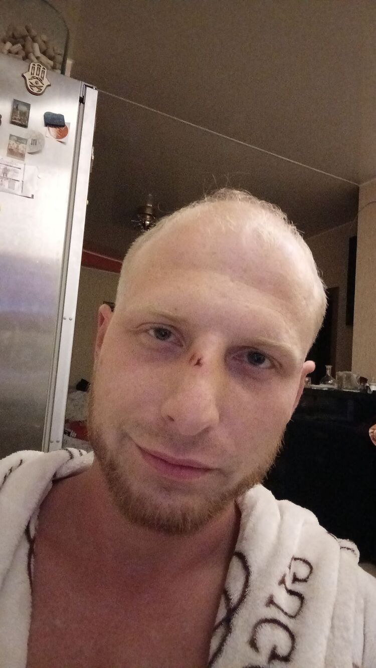  46633970  , 33 ,    