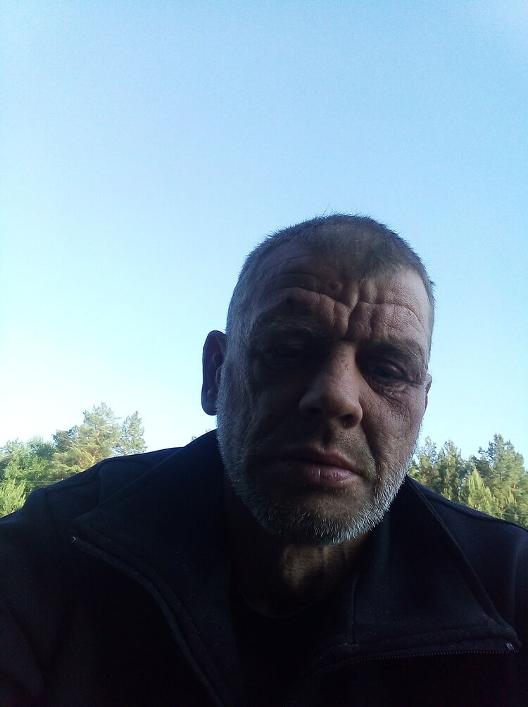  35204980  , 47 ,    