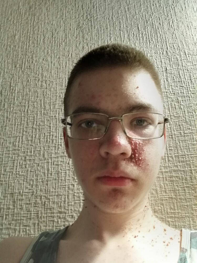  33920660  , 21 ,    