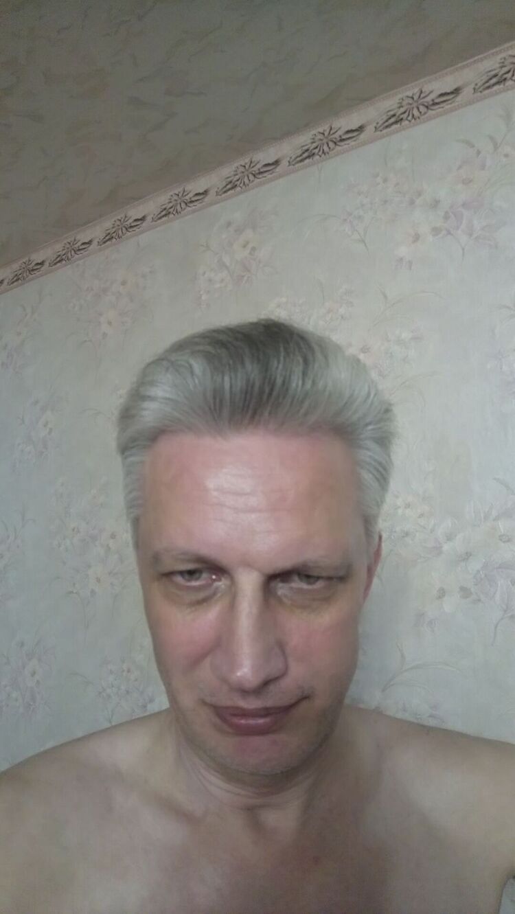  34657030  , 56 ,    