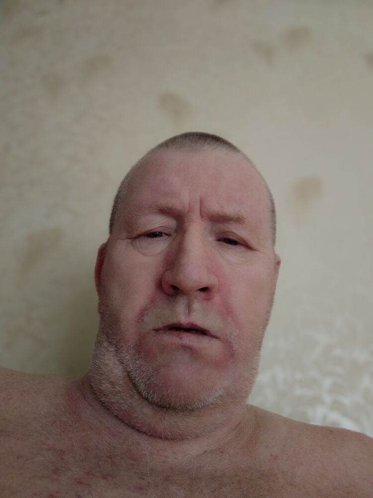  35191830  , 63 ,    