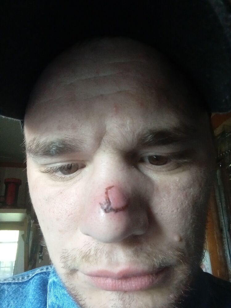  35395280  , 31 ,    