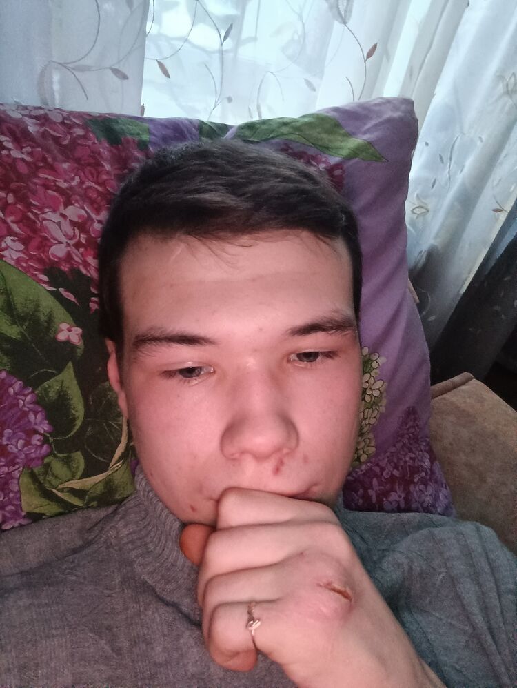  32835850  , 22 ,    