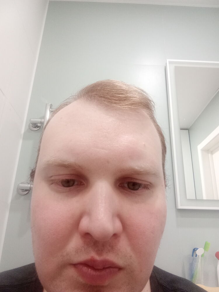  38834930  , 32 ,    