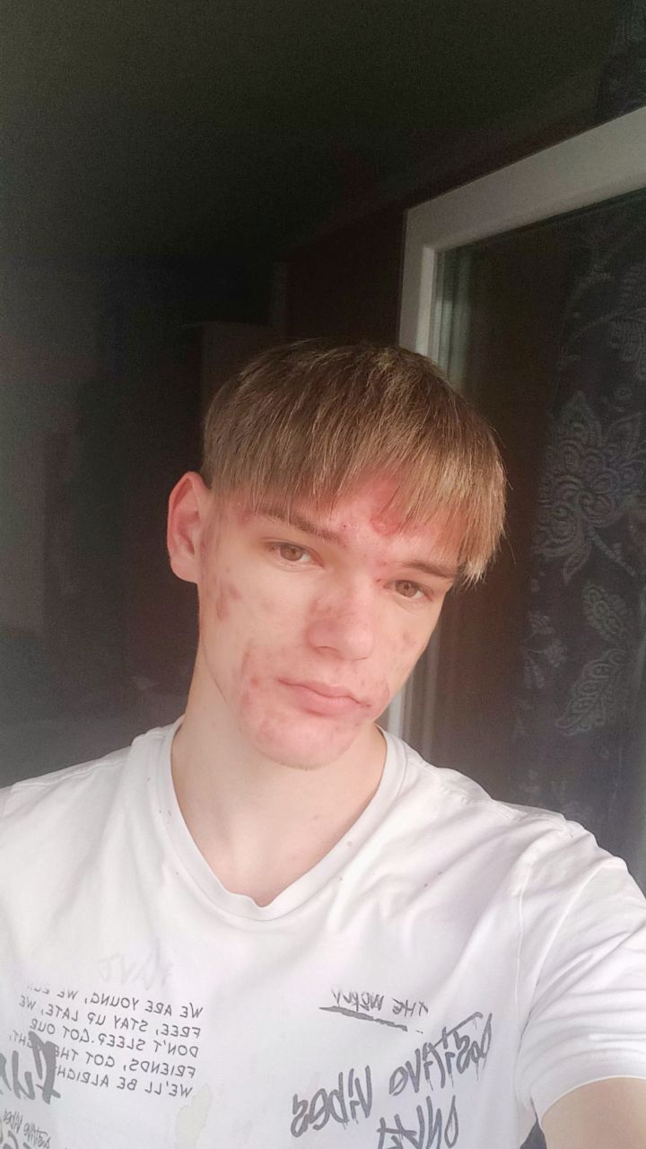 ���������� �����������, ���� ����� ����, 21 ���, ������������ ��� ������