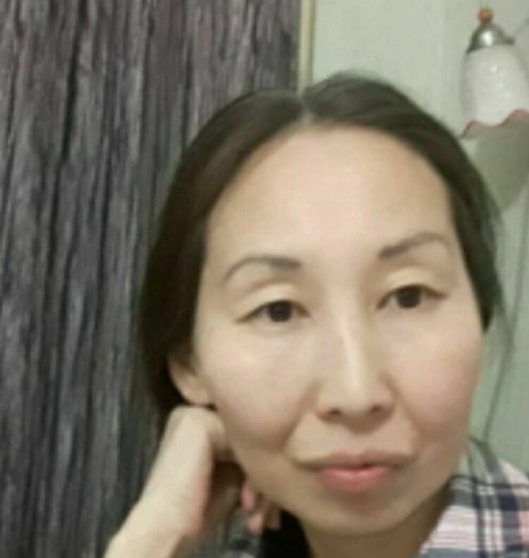  52415560  , 44 ,    
