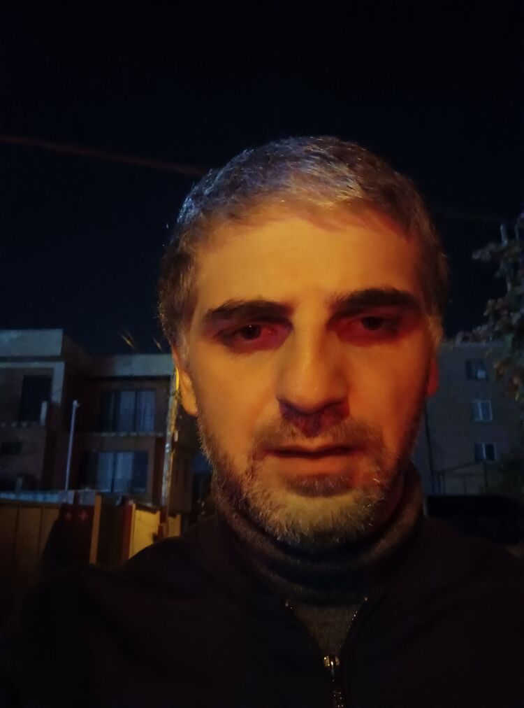  47262280  Giorgi, 34 ,    