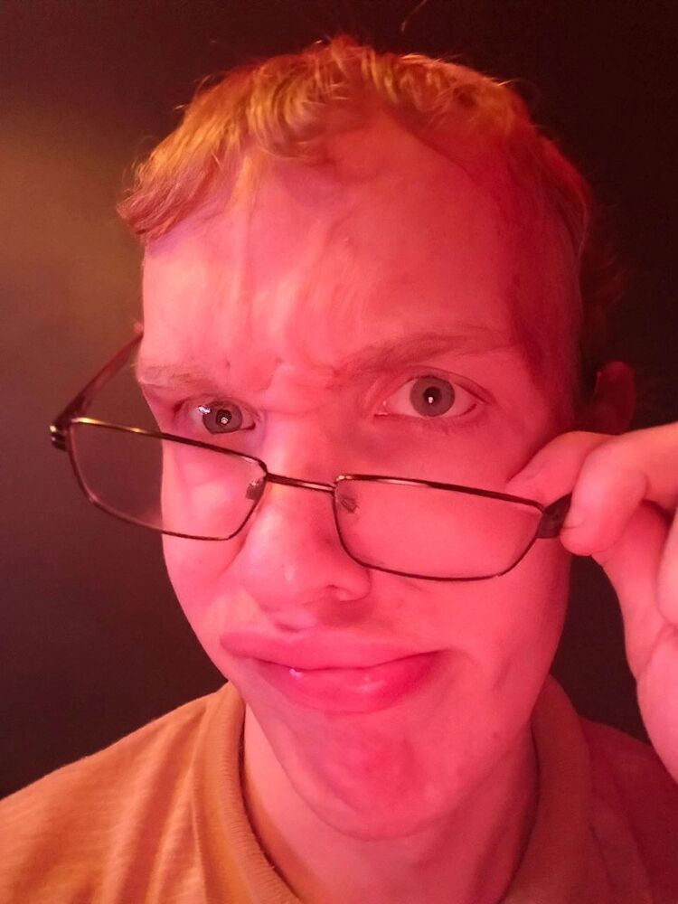  48354290  , 18 ,    --