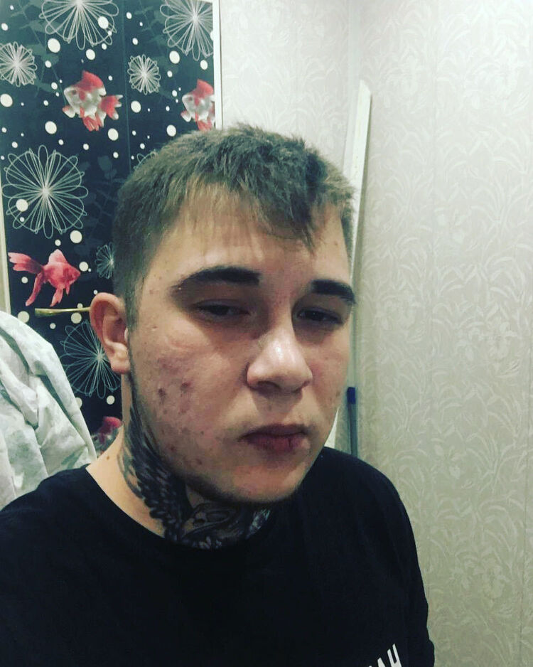  31142960  , 28 ,    