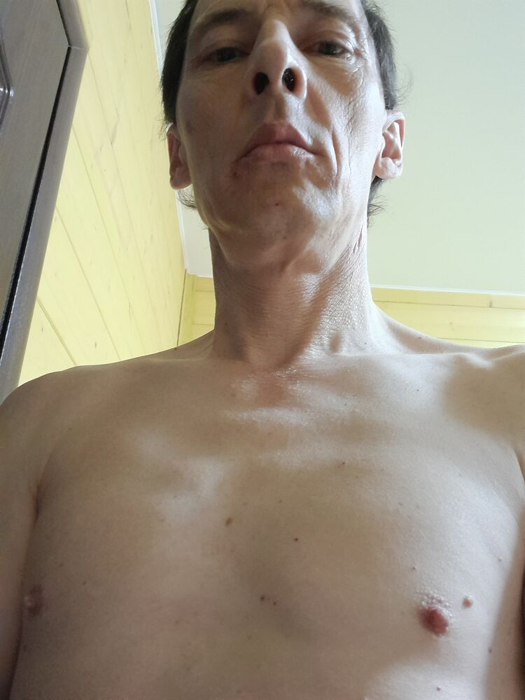 34425210  , 47 ,    