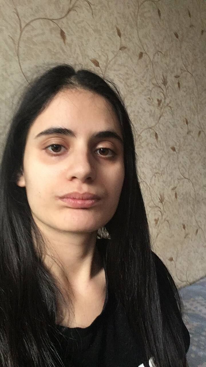  42514580  , 19 ,    
