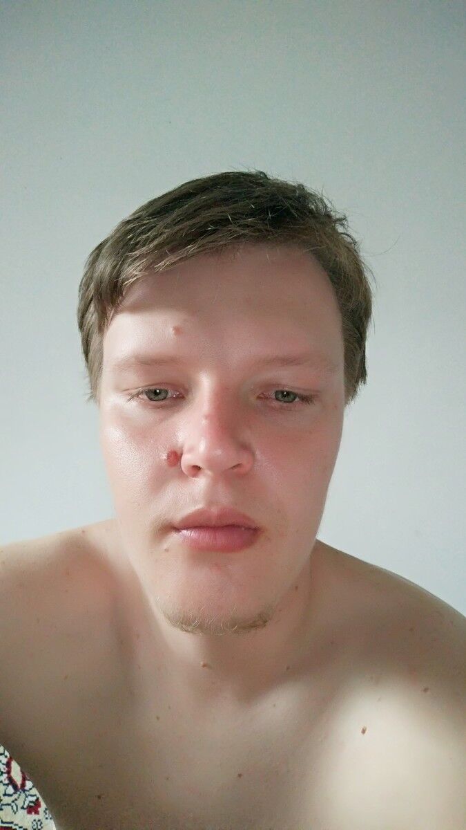  12362390  , 35 ,    