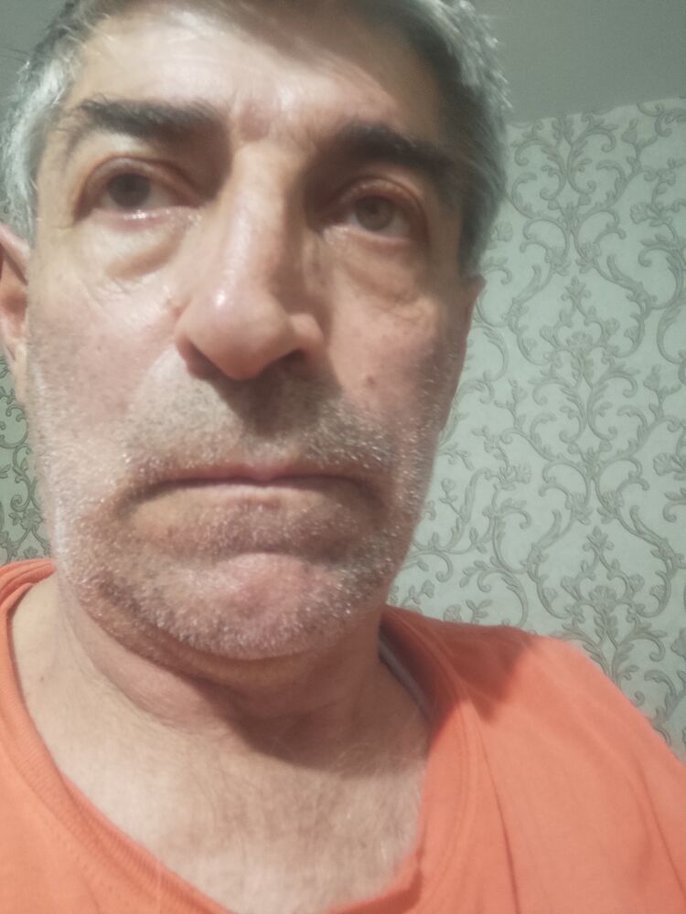 35495750  , 57 ,    