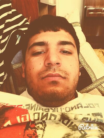  ,   Arm77155785, 34 ,   