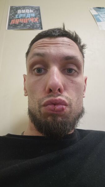  --,   GERMAN, 32 ,   ,   