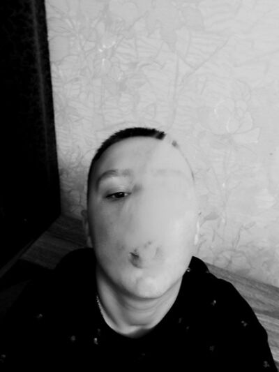  ,   Gold, 21 ,   ,   