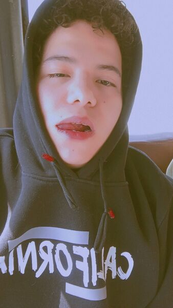  ,   MODY, 19 ,   ,   